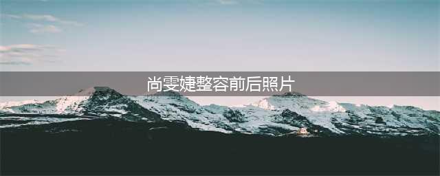 一代歌王尚雯婕的整容之谜(尚雯婕整容前后照片)
