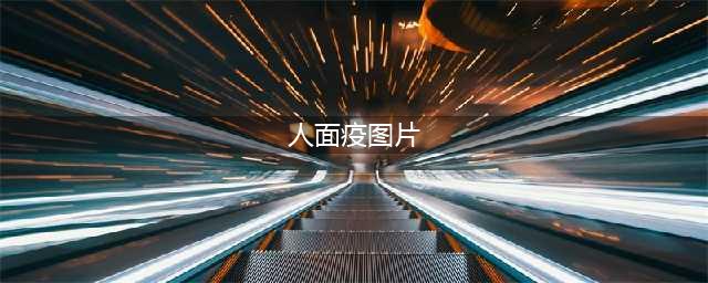 天官赐福人面疫终于来了！这怪病现实世界也有，真吓人！(人面疫图片)