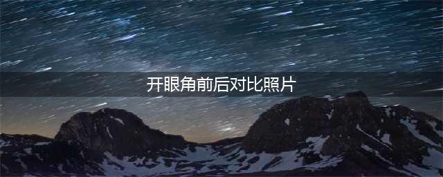 开眼角手术前后对比图(开眼角前后对比照片)