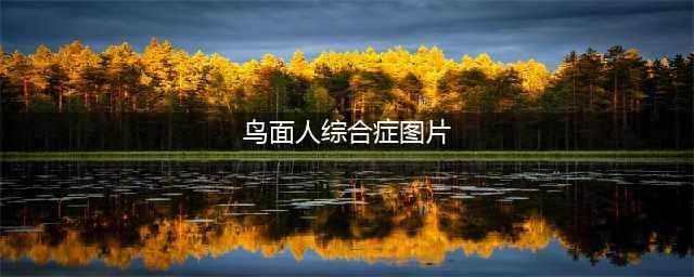 【科普】罕见病科普系列：千人一面——鸟面综合征(鸟面人综合症图片)